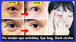 Only 6 mins!! Eye rejuvenation. Get rid of under eye wrinkles, dark circles, eye bags, Crow