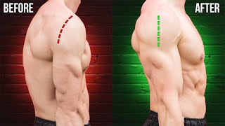How I Fixed Rounded Shoulders Forever