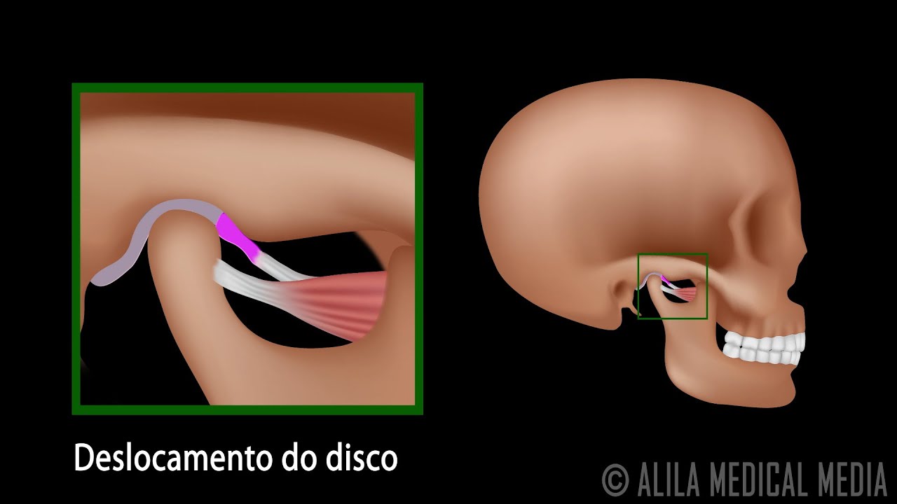 Aprigio Zangerolami-11