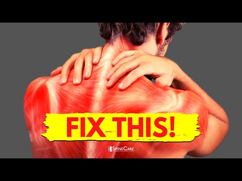How to Fix a Tight Neck in 30 SECONDS