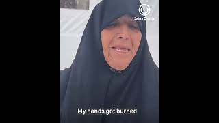 My hands got burned”  | #SaySalam | Salam Charity