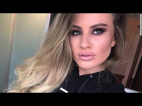 UK model kidnapped for dark web auction reveals ordeal