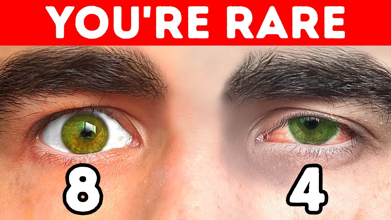 18 Rarest Body Features Your Friends Might Have