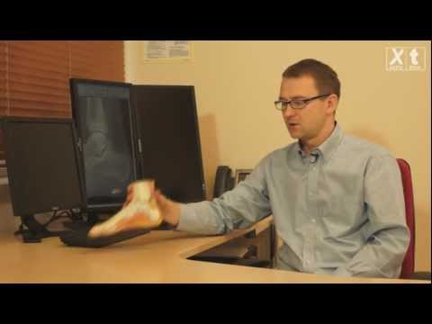 Extra Time: choroba Severa - ból pięty