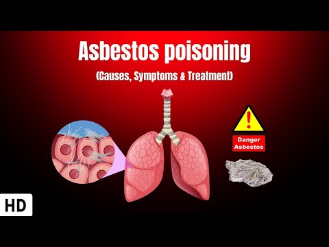 Nasal and Paranasal Tumors Causes Signs and Symptoms Diagnosis and Treatment