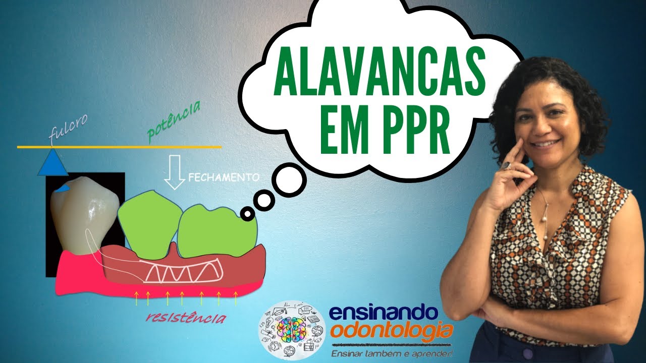 Alavancas em PPR