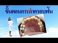 ขั้นตอน