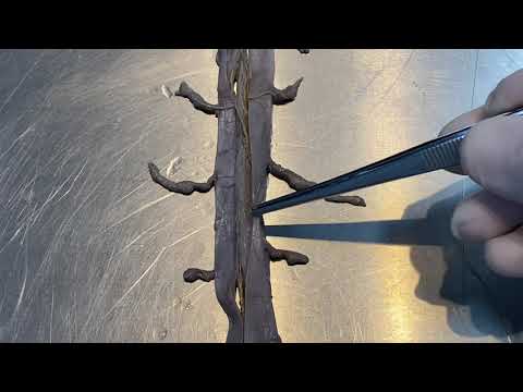 Aula prática de Medula Espinal