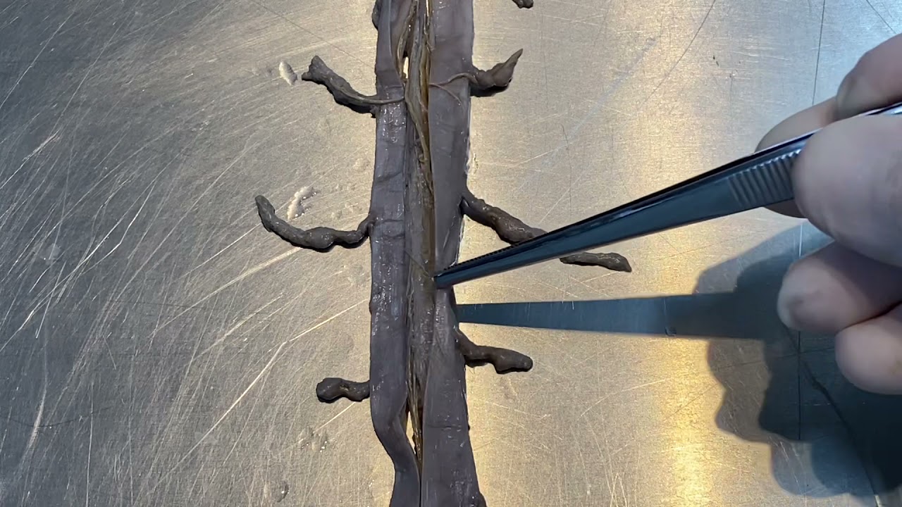 Aula prática de Medula Espinal