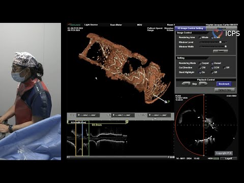 Left main and complex bifurcation stenting - EuroPCR 2024