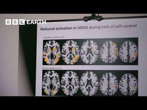 Why Do People With ADHD Behave The Way They Do? | Horizon | BBC Science