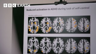 Why Do People With ADHD Behave The Way They Do? | Horizon | BBC Science