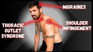 HERES Why You Get “RANDOM” Shoulder Pain & Migraines