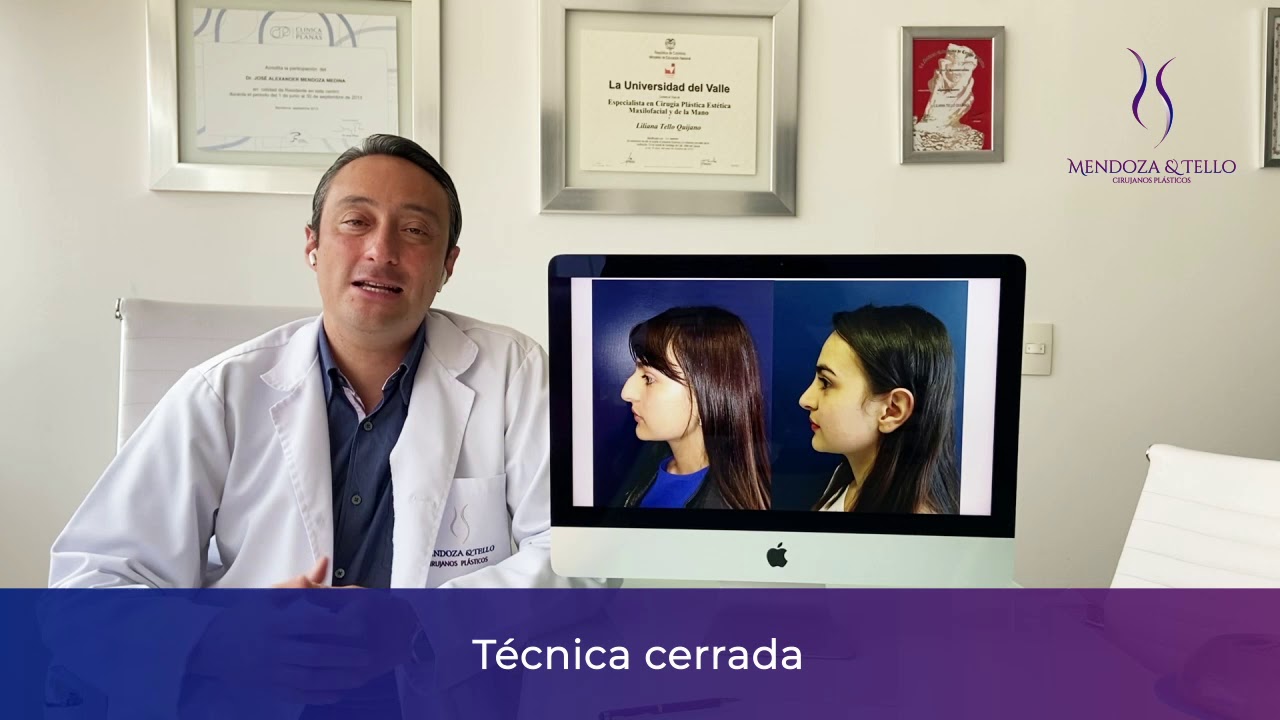 Alexander Mendoza-101