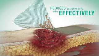 Sorbact Technology : Cutimed Sorbact - Mode of Action [English]