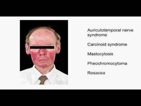 Charité Clinical Journal Club by Fred Luft - 16.07.2014