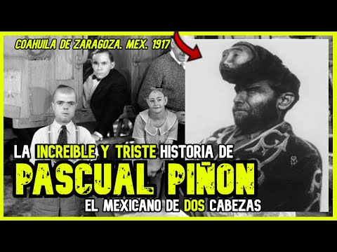 El mexicano de DOS CABEZAS | Una historia IMPACTANTE