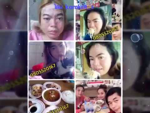 ป่วยเพราะสิ่งที่เป็นโรคสะเก็ดเงิน โรคผิวหนัง, โรคสะเก็ดเงินบนหัว
