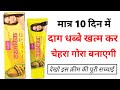 Vi John Turmeric Skin Cream Review How To Use Vi John Turmeric Skin Cream