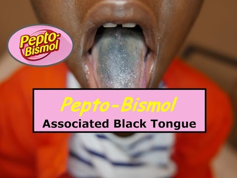 download lagu mp3 mp4 Black Coating On Tongue, download lagu Black Coating On Tongue gratis, unduh video klip Black Coating On Tongue