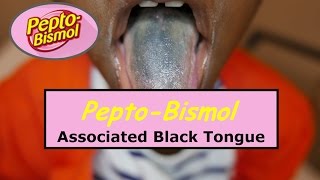 Pepto-Bismol Associated Black Tongue