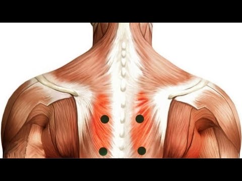 Painful Shoulder Knots - YouTube