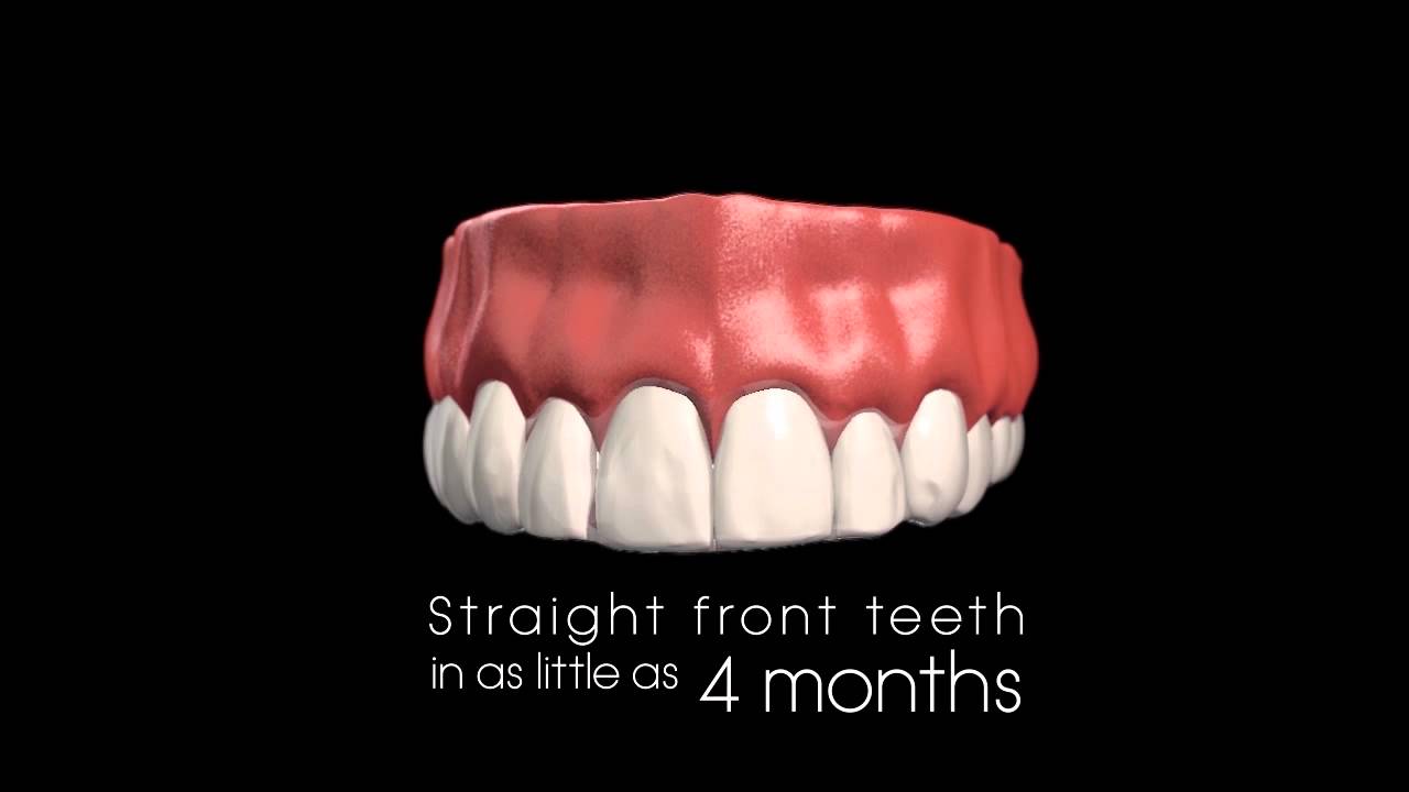 take a look thumbnail