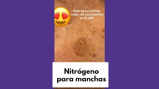Tratar las manchas con nitrógeno liquido 🤓 #shorts