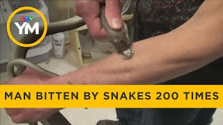 Man allowed snakes to bite him 200 times — CTV Your Morning