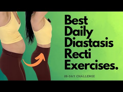 Heal & Flatten With These Daily Diastasis Recti Exercises!