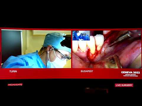 Does the digital approach improve treatment efficiency?