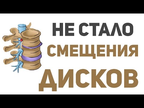 Диета для суставов Боли в области сердца отдающие в спину