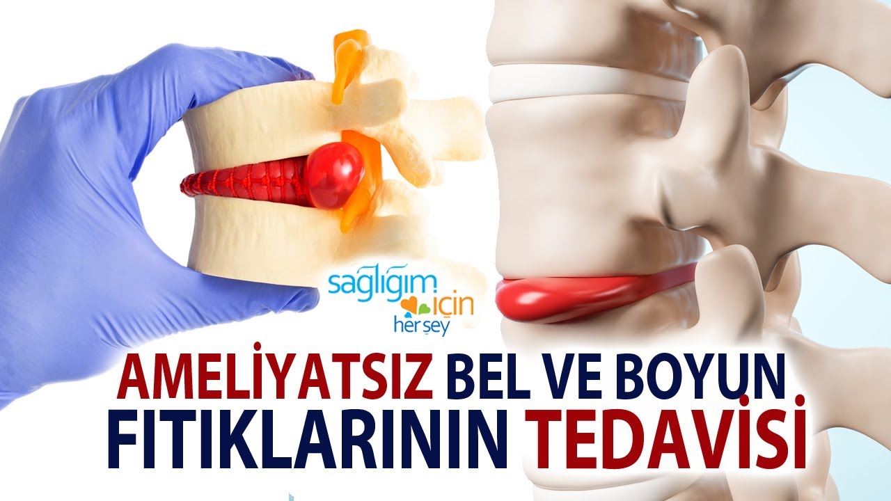 Bel ve Boyun Fıtığı Problemi