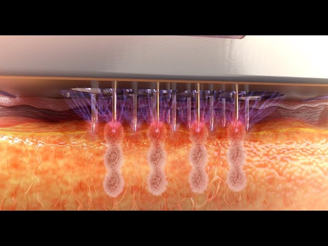 Youtube - Line Permanent Kosmetik