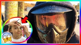 TYLER HAS A PARTY - WHAT HAPPENED TO KAYLA&#39;S FACE? | We Are The Davises