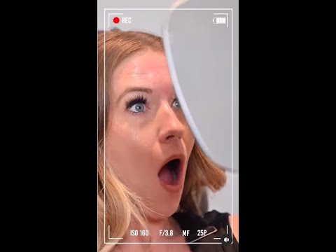 PDO Thread Lift | Real Patients Testimonials at Suddenly Slimmer Med Spa Phoenix