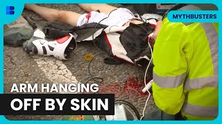 Motorcyclist Loses Arm in A47 Crash Rescue | Air Ambulance ER