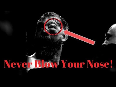 Never Blow A Damaged Nose! Here's Why. Video