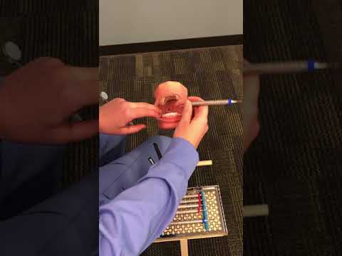 Sickle Scaler Process Eval: Nevi 1