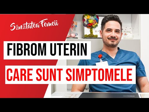 Care sunt SIMPTOMELE FIBROMULUI UTERIN