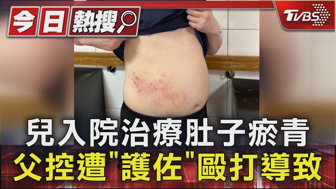 兒入院治療肚子瘀青 父控遭「護佐」毆打導致