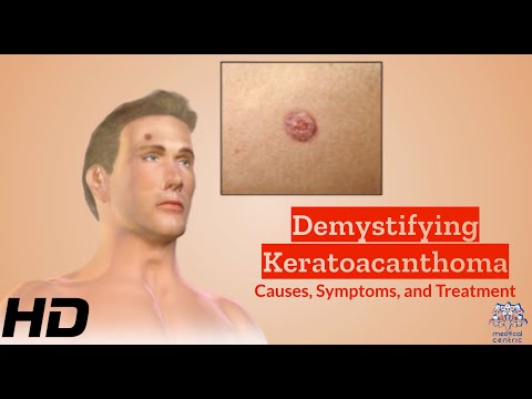 Effects of Cannabis on your body