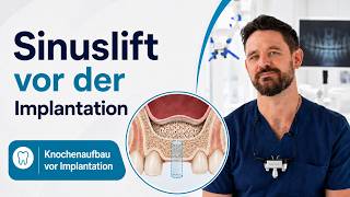 Sinuslift