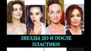 Звезды, которые сделали пластические операции | Top Show News