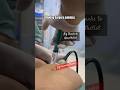 Injection Makes Operation Painless How Surgery Be Painless By Anaesthesia TAP BLOCK B4 Surgery