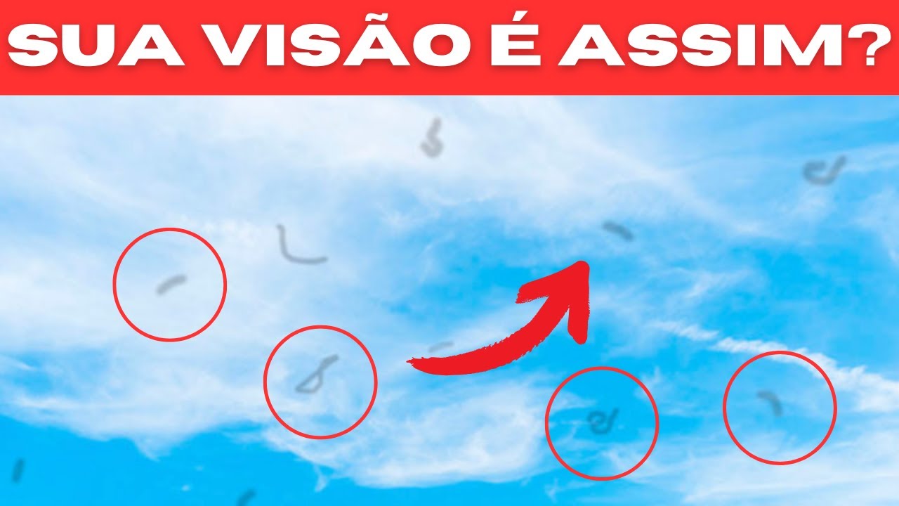 ENXERGA MOSCAS VOLANTES? SAIBA COMO ACABAR COM ELAS
