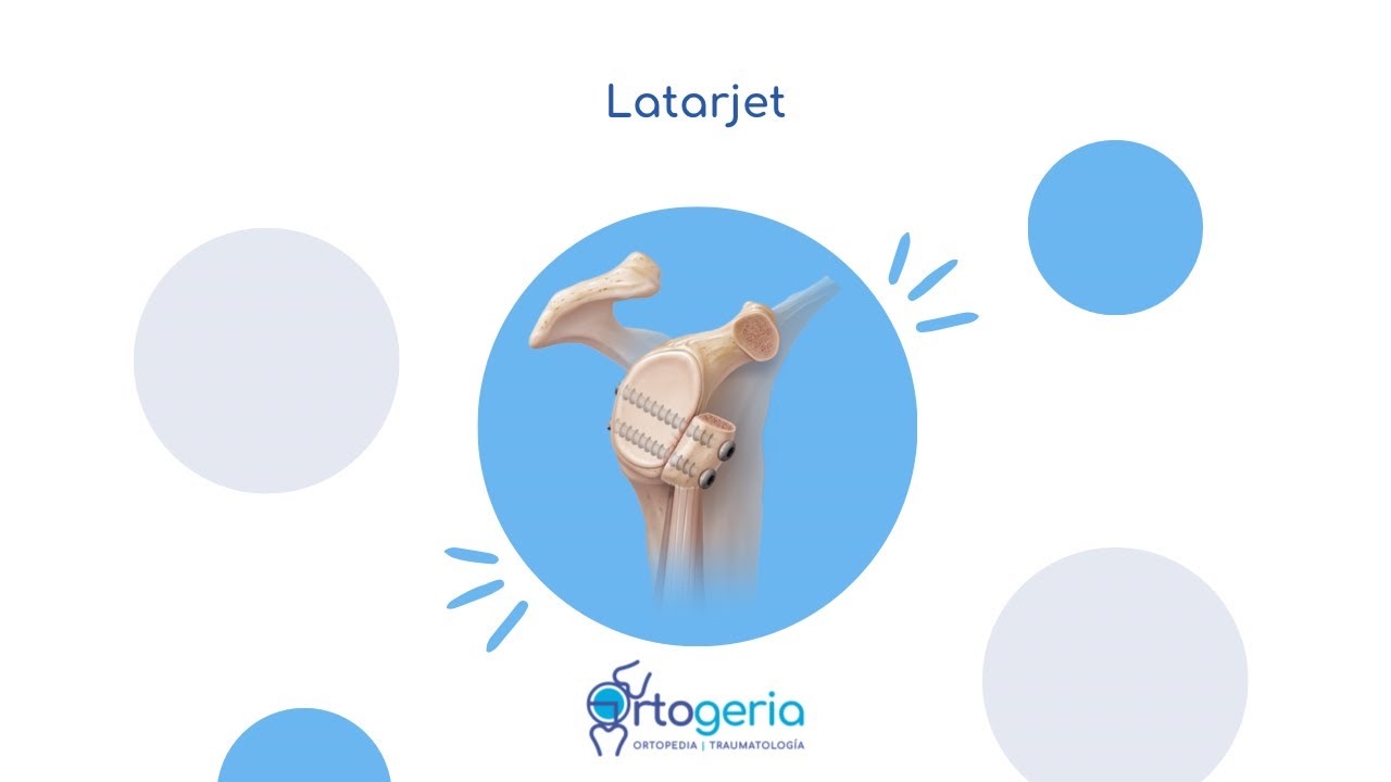 Eliud Jair Benavides Lombard-9