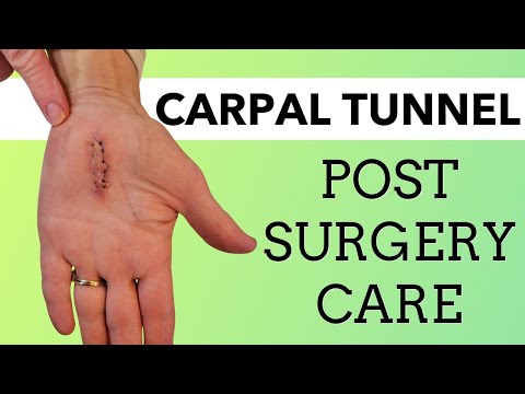 After Carpal Tunnel Surgery: Best Exercises to Restore Max. Function, Strength, & Pain Free