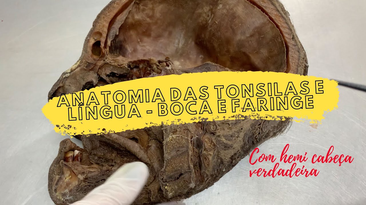 Anatomia das tonsilas e língua - Boca e Faringe