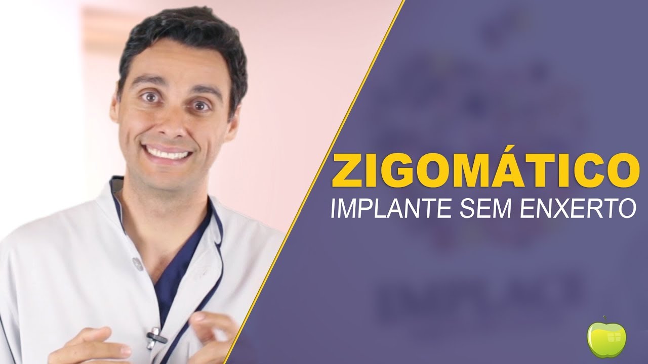 Zigomático! Implante Boca Toda Sem Enxerto!